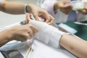 Understanding Common Causes of Burn Injuries in Bucks County, Pennsylvania